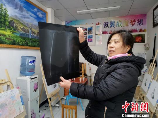 双胞胎“瓷娃娃”卧病在床10余年 自学画画开画室